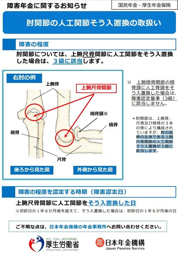 人工 骨頭 人気 置換 術 身体 障害 手帳